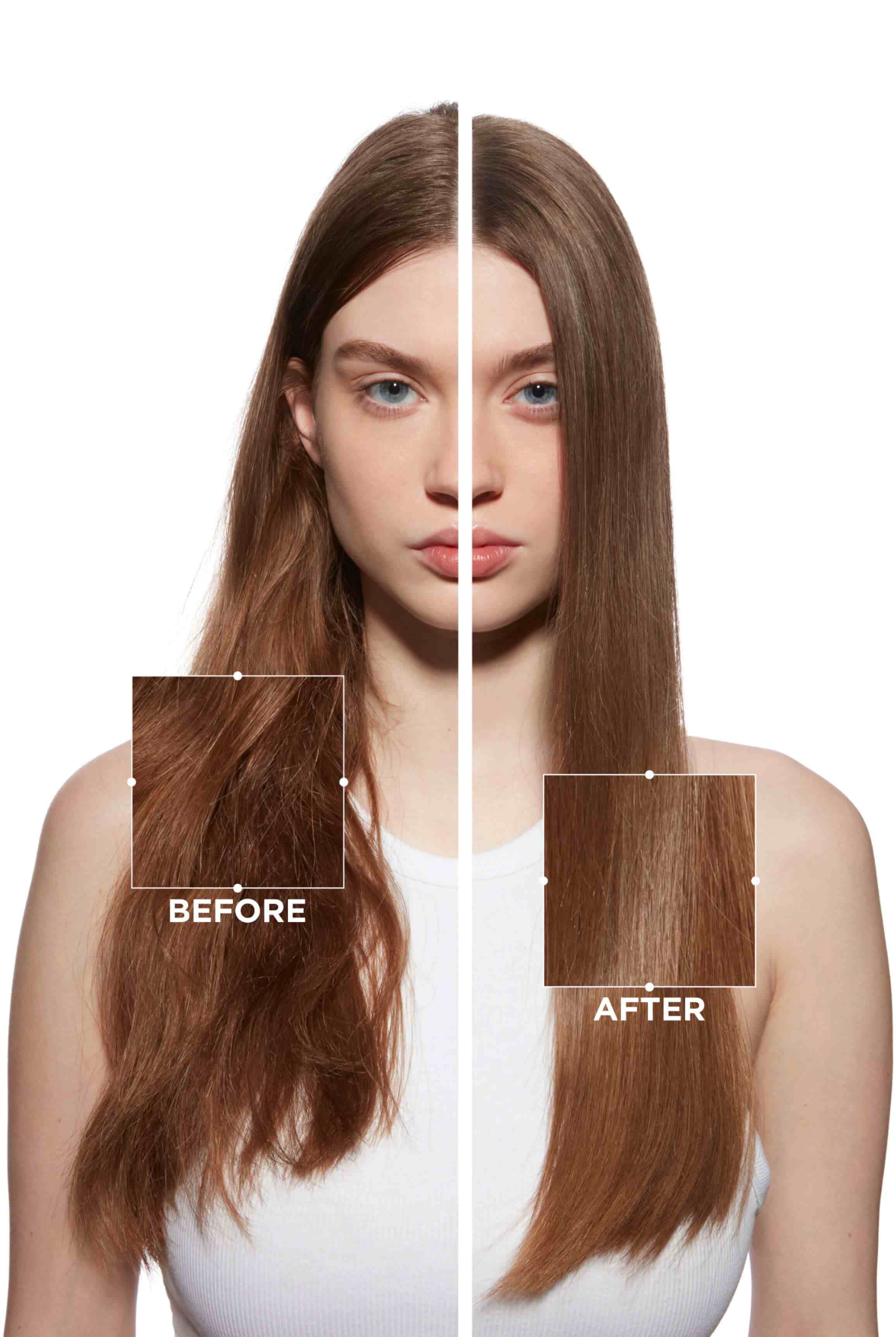 Before and after results by Fusio-Dose