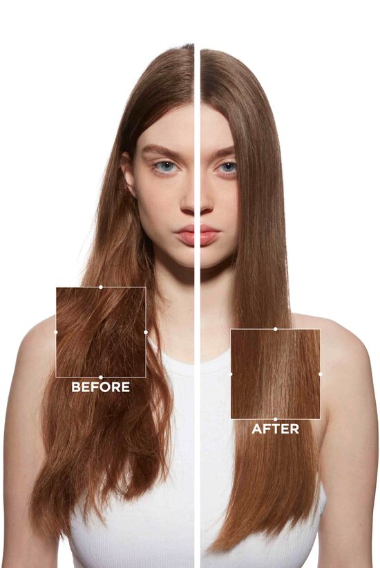 Before and after results by Fusio-Dose