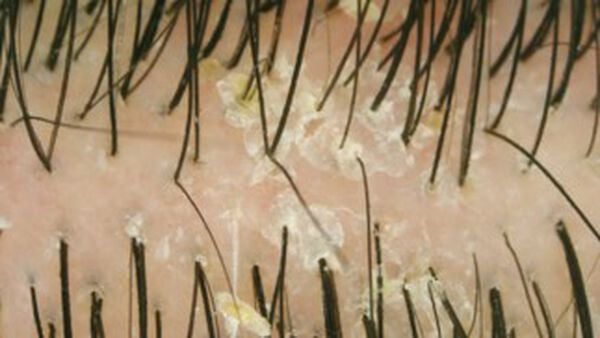 At-Home Blonde Care