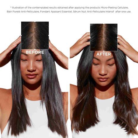 Symbiose Anti-Dandruff Regime for Oily Scalp