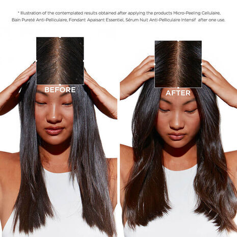 Symbiose Cellulaire Nuit Anti-Dandruff Scalp Serum Intensif